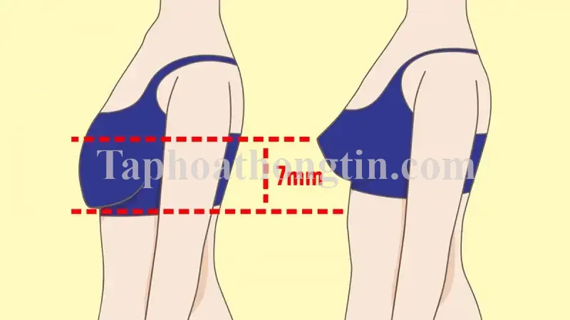 Ngực xệ ở tuổi dậy thì – Nguyên nhân và cách khắc phục